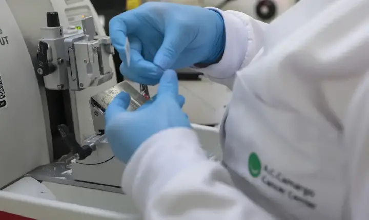 SUS inclui nova terapia para pacientes adultos com leucemia mieloide