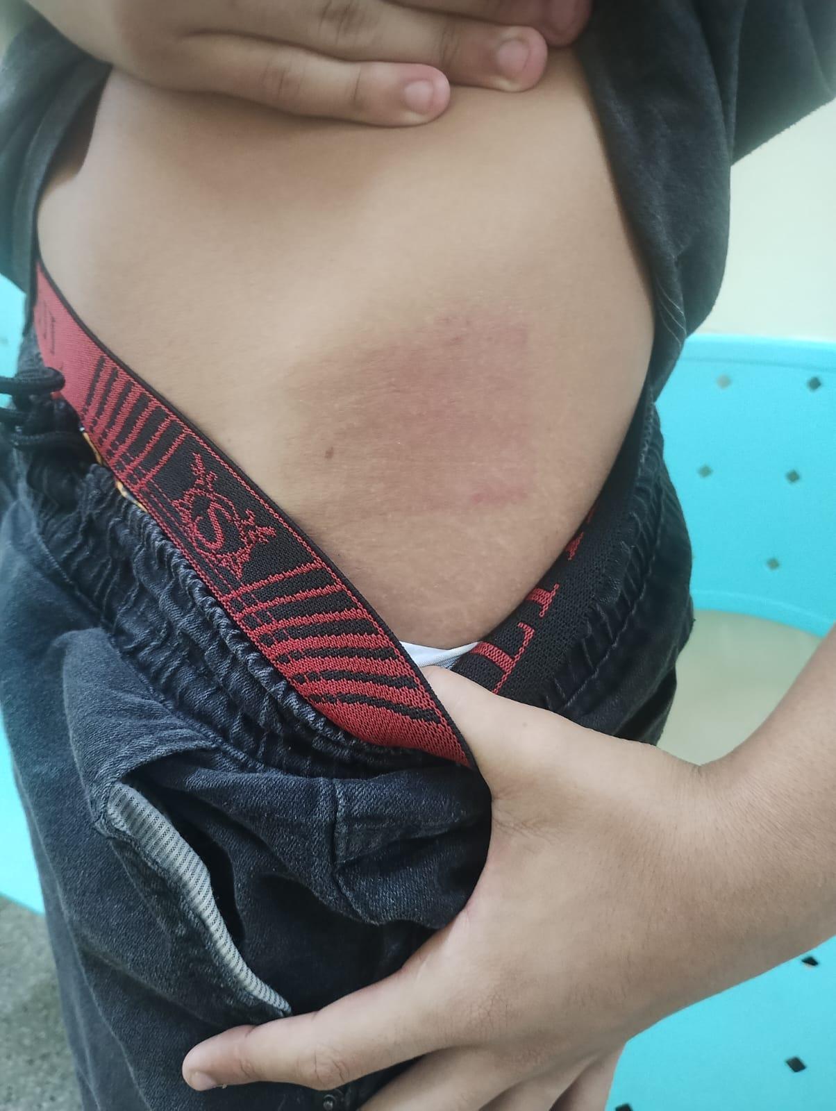 'Me chamou de bandido', diz adolescente autista agredido por ex-militar em Manaus