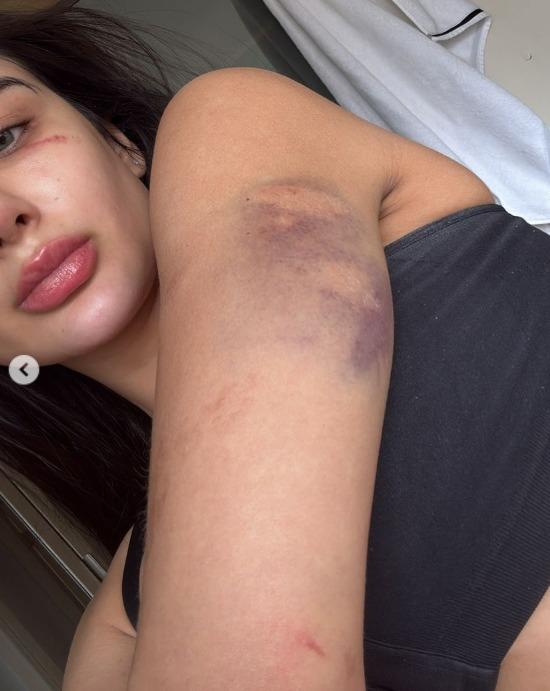 Miss Amazonas denuncia agressões e ameaça de morte