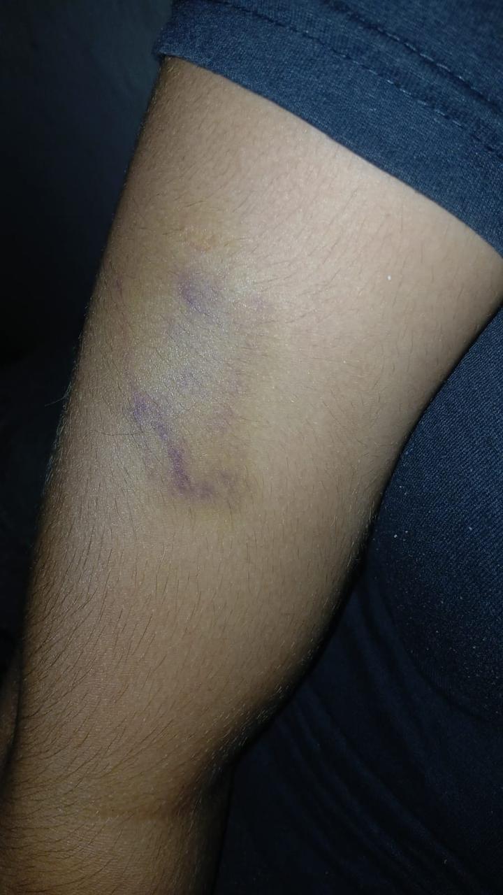 Mulher acusa companheiro, sogra e cunhada de agressões